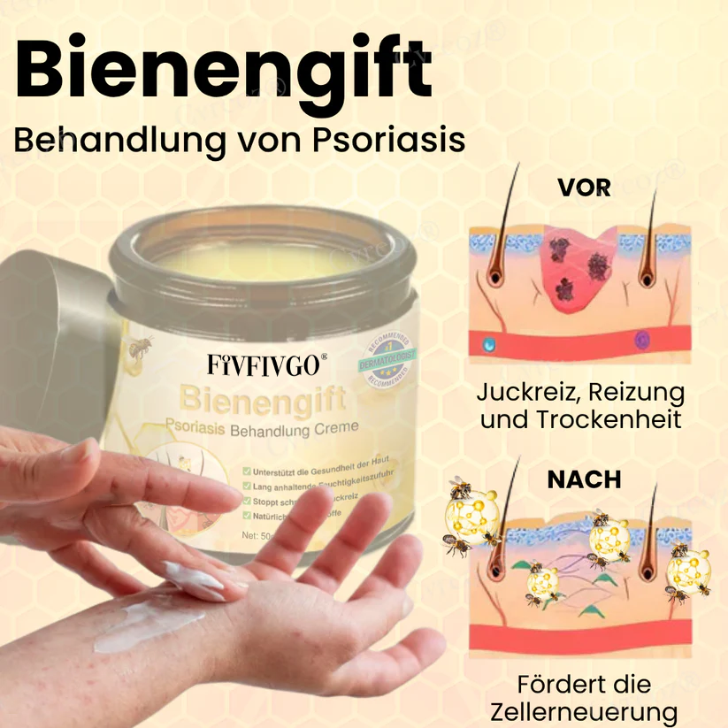 Fivfivgo® Bienengift Psoriasis Behandlung Creme