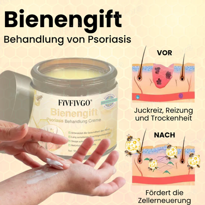 Fivfivgo® Bienengift Psoriasis Behandlung Creme