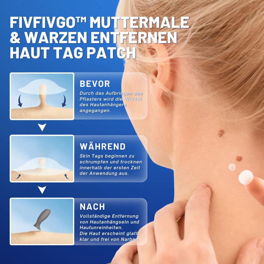 Fivfivgo™ Muttermale & Warzen entfernen Haut Tag Patch