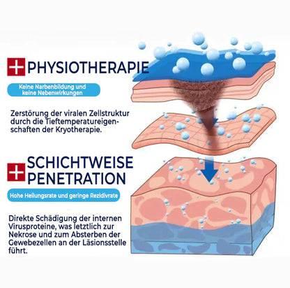 Fivfivgo® TagRecede Kryo-Behandlungsspray