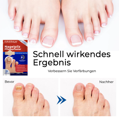 Fivfivgo® Nagelpilz Pflegepflaster
