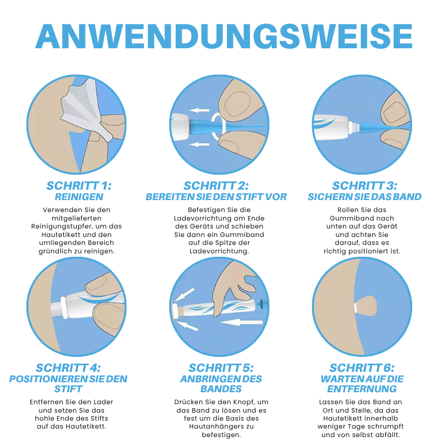 Fivfivgo® Schmerzfreier Stift zur Entfernung von Hautmarkierungen zu Hause