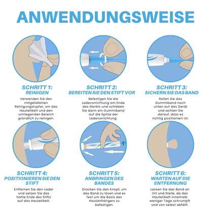 Fivfivgo® Schmerzfreier Stift zur Entfernung von Hautmarkierungen zu Hause