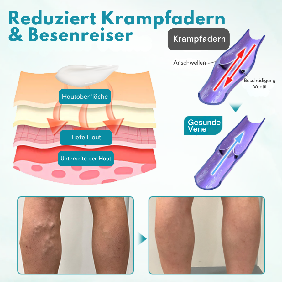 Fivfivgo® VeinEase Beruhigende Creme