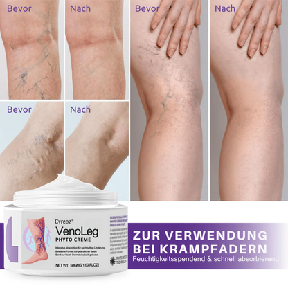 Cvreoz® VenoLeg Phyto Creme - Sichtbare Ergebnisse in nur 4 Tagen🔥
