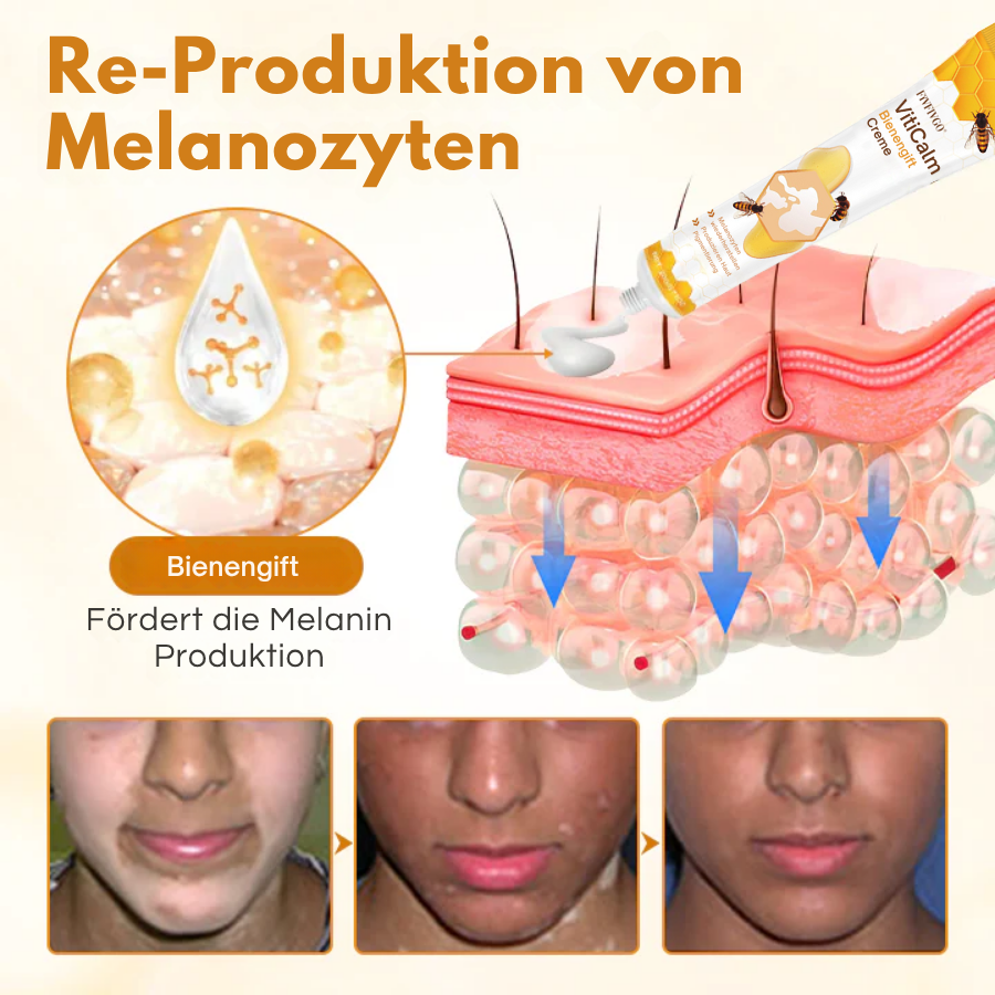 Fivfivgo® VitiCalm Bienengift-Creme PRO