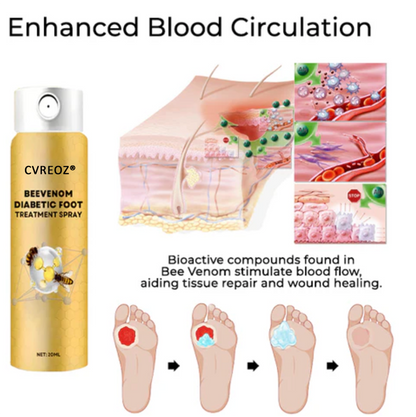 Cvreoz® BeeVenom Diabetiker-Fußpflege-Spray