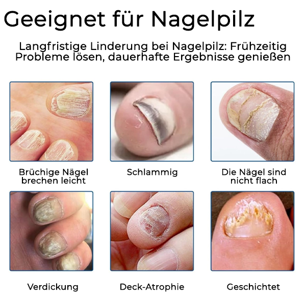 Fivfivgo® Nagelpilz Pflegepflaster