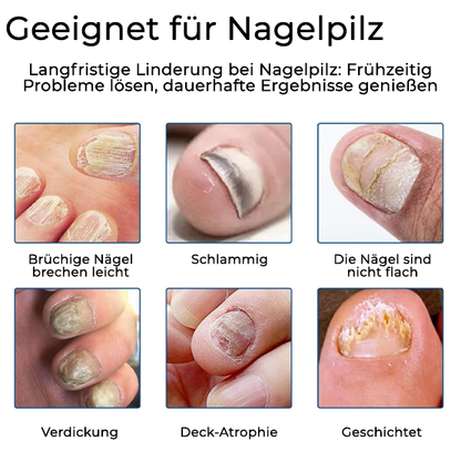 Fivfivgo® Nagelpilz Pflegepflaster