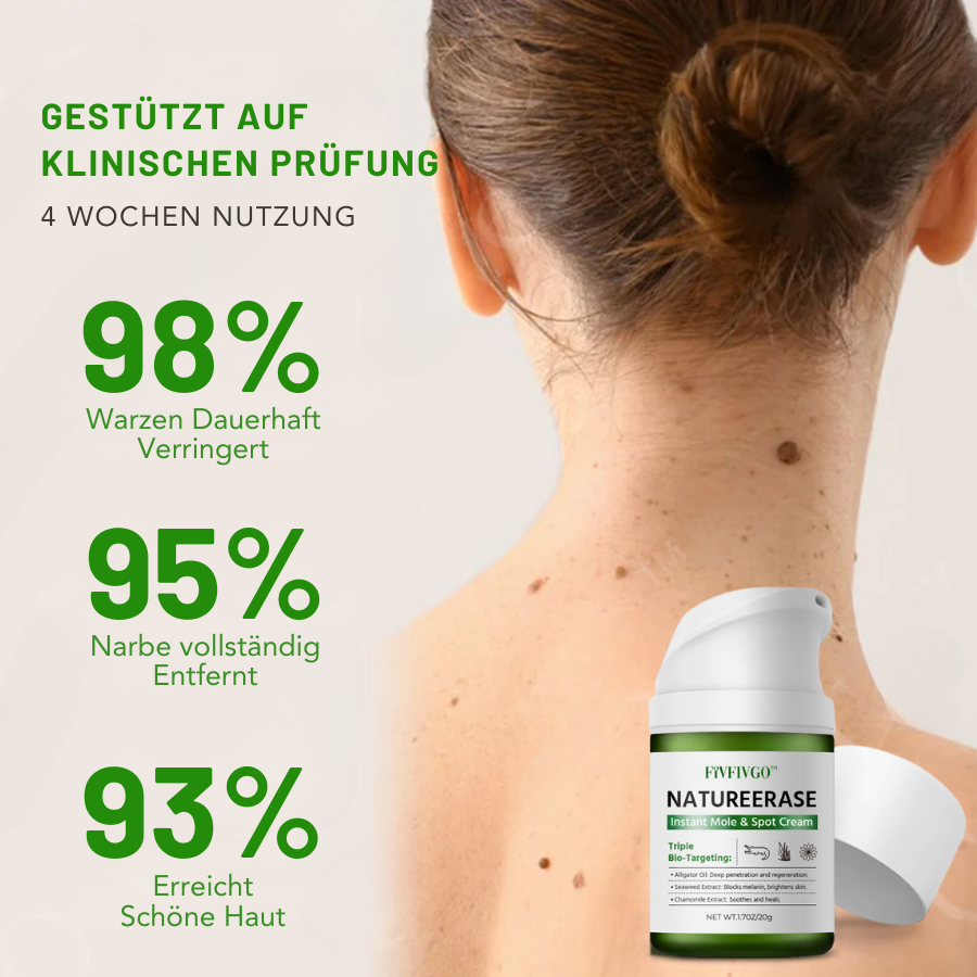 Fivfivgo® NatureErase Sofortige Maulwurf- und Fleckencreme