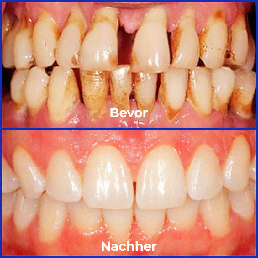 Fivfivgo® Bienengift Behandlung Pulver zum oralen Gebrauch