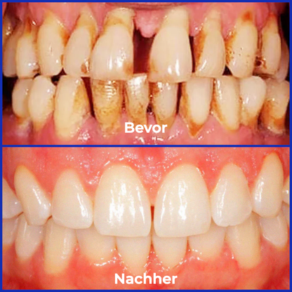 Fivfivgo® Bienengift Behandlung Pulver zum oralen Gebrauch