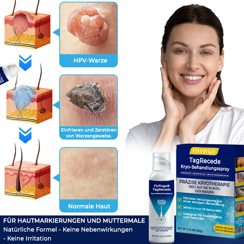Fivfivgo® TagRecede Kryo-Behandlungsspray