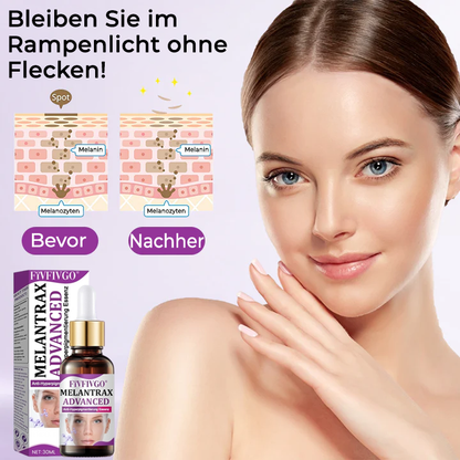 Fivfivgo® MelantraX Advanced Anti-Hyperpigmentierung Essenz