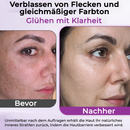 Fivfivgo® MelantraX Advanced Anti-Hyperpigmentierung Essenz