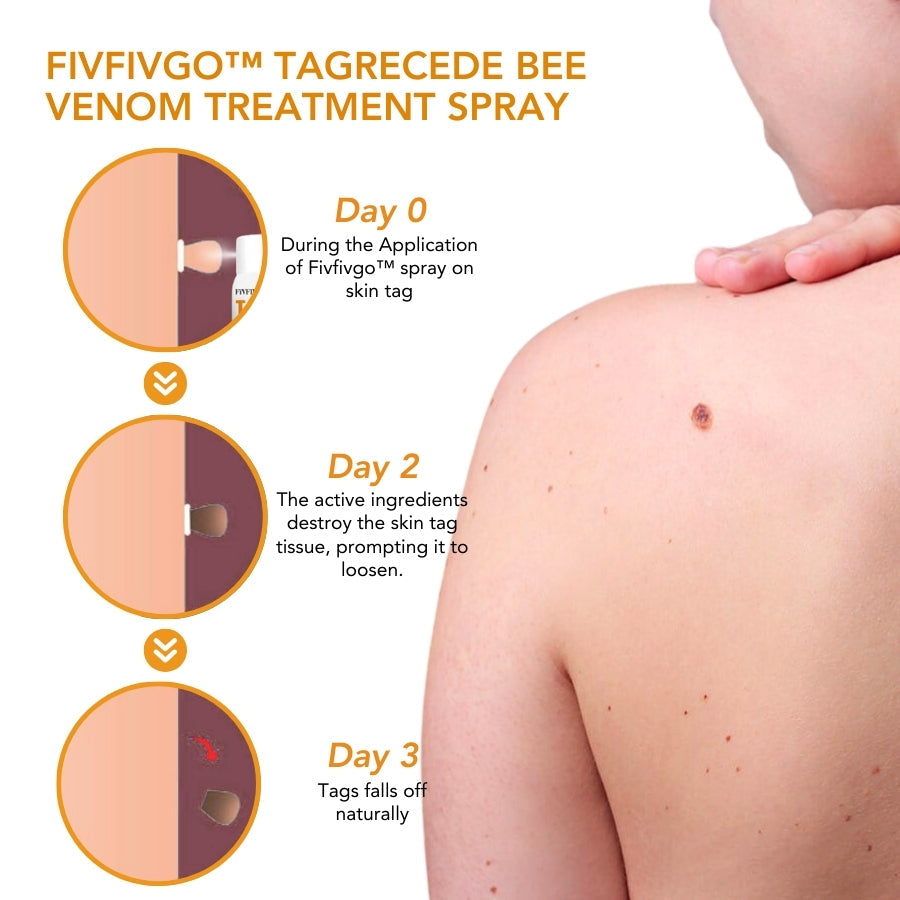 Fivfivgo™ TagRecede Bienengift Behandlung Spray
