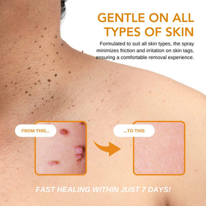 Fivfivgo™ TagRecede Bienengift Behandlung Spray