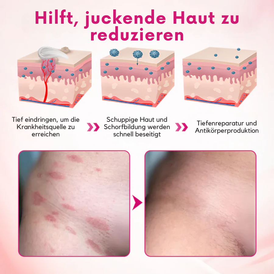 Fivfivgo® IntiDefend Anti-HPV-Interferon das Gel
