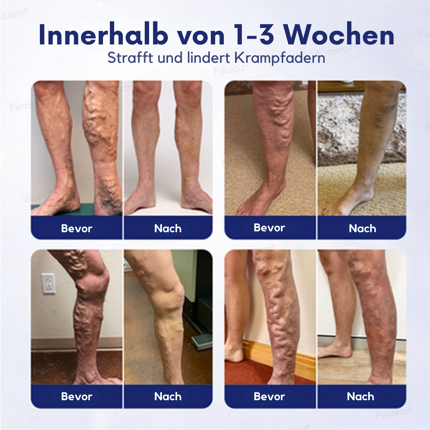 NovaRX® VeinFreedom Kräuterspray - Mikronebeltherapie