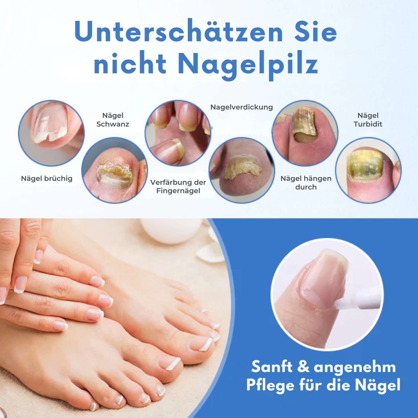 Fivfivgo® MycoErase Nagel Stift Wiederbeleben