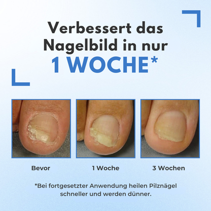 Fivfivgo® MycoErase Nagel Stift Wiederbeleben
