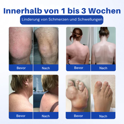 NovaRX® BPC-157 Gelenk & Knochen Reparieren Roll-On Gel