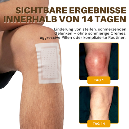NovaRX® Bienengift-Joint Therapie-Botanischer Patch