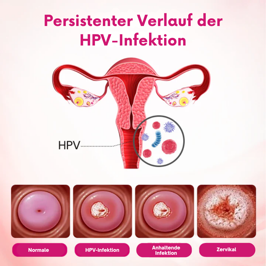 Fivfivgo® IntiDefend Anti-HPV-Interferon das Gel