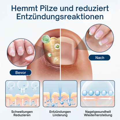 Fivfivgo® OnyxiGuard Pilzreparatur Kräuterspray PRO