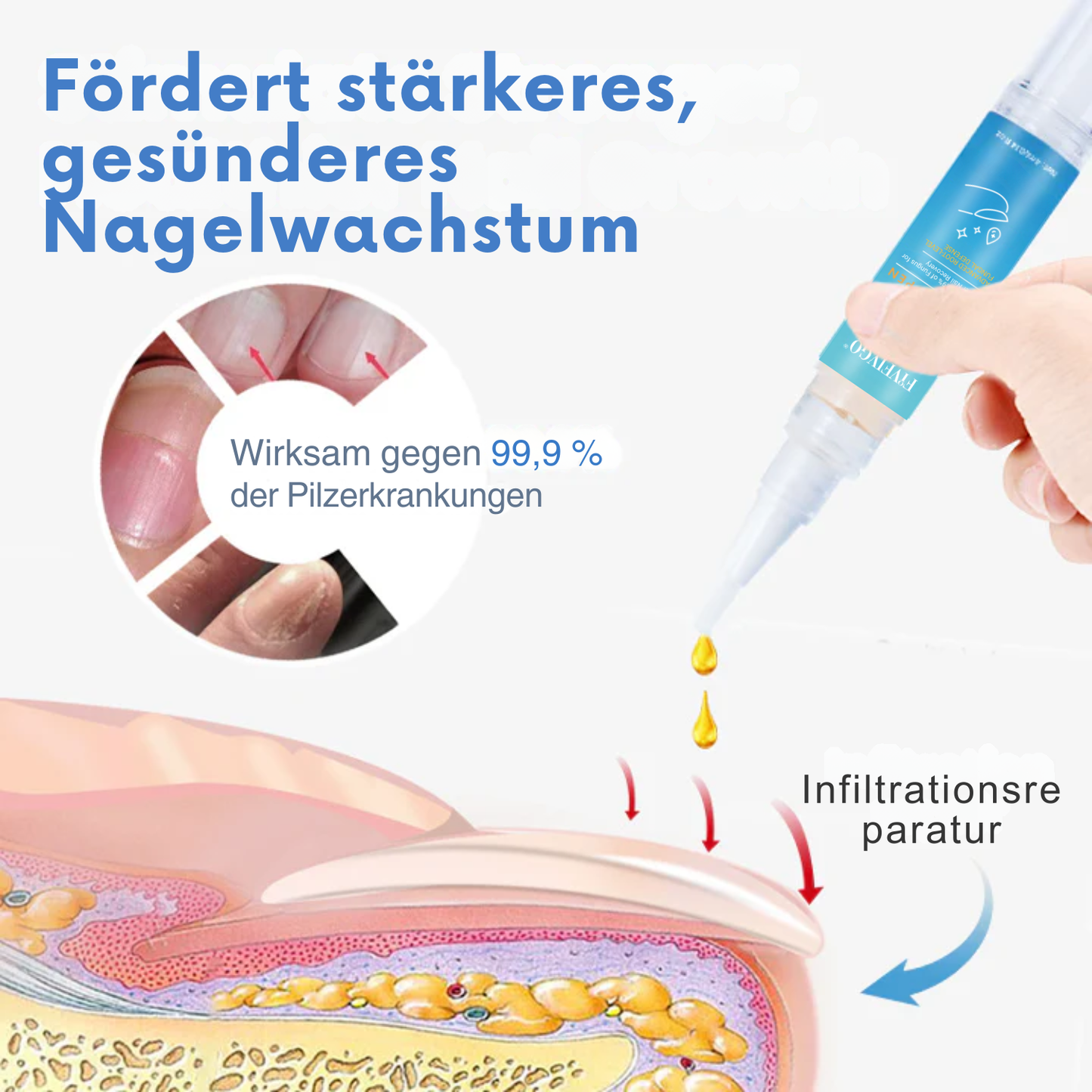 Fivfivgo® MycoErase Nagel Stift Wiederbeleben