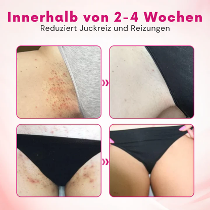 Fivfivgo® IntiDefend Anti-HPV-Interferon das Gel