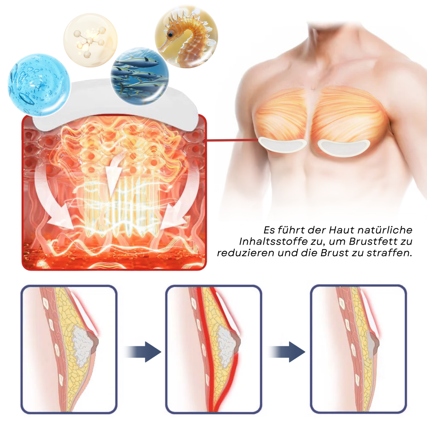 Fivfivgo® SculptXX Gynäkomastie Brennen & Straffen Brust Patch