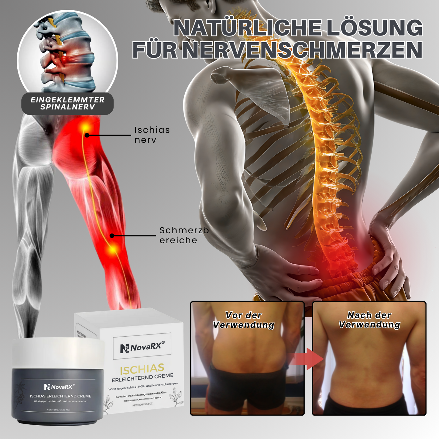 NovaRX® Ischias Erleichternd Creme