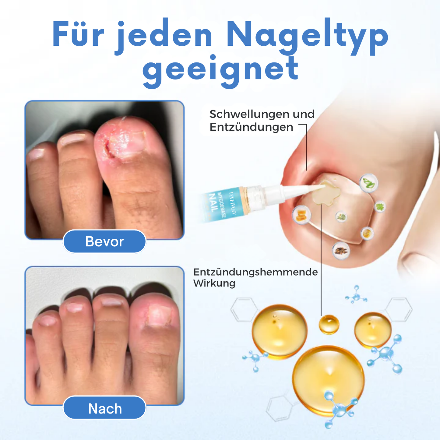 Fivfivgo® MycoErase Nagel Stift Wiederbeleben