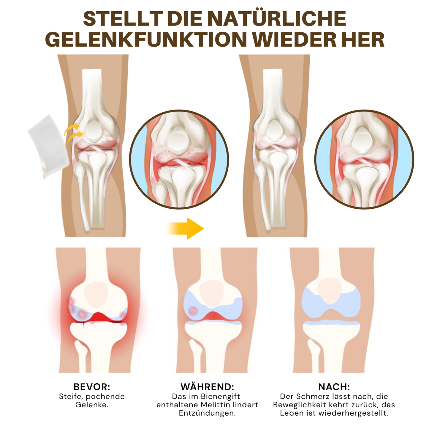 NovaRX® Bienengift-Joint Therapie-Botanischer Patch