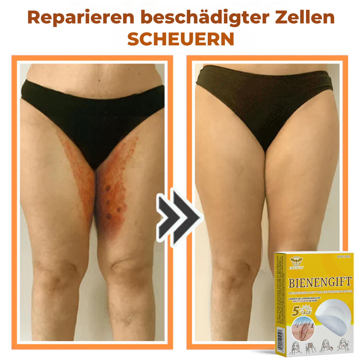 Fivfivgo® Bienengift Botanische Haut Tag Entfernung Patch 🇩🇪 Hergestellt in den Germany