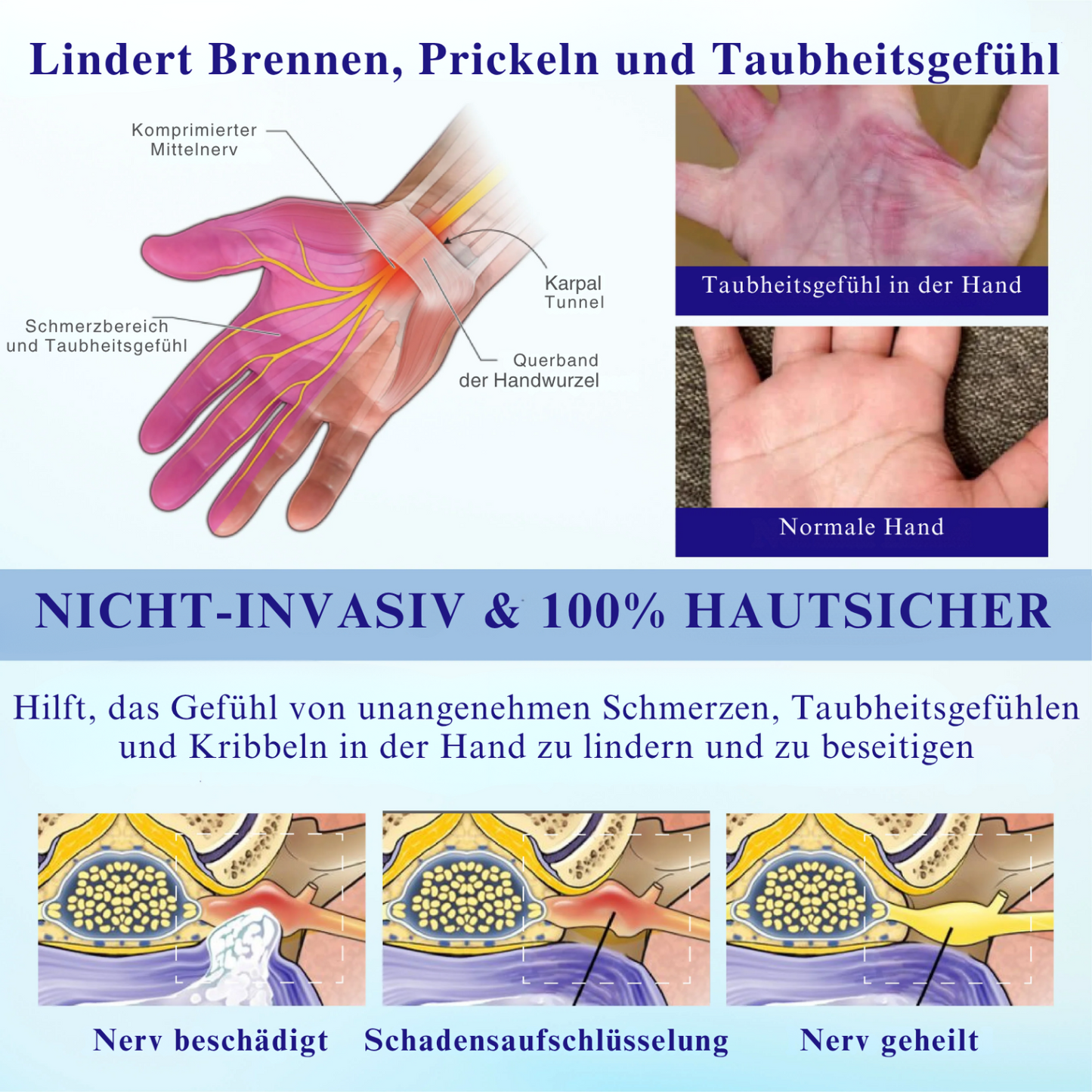 NovaRX® BetäubenWeg CooleLindern Neuropathie-Spray