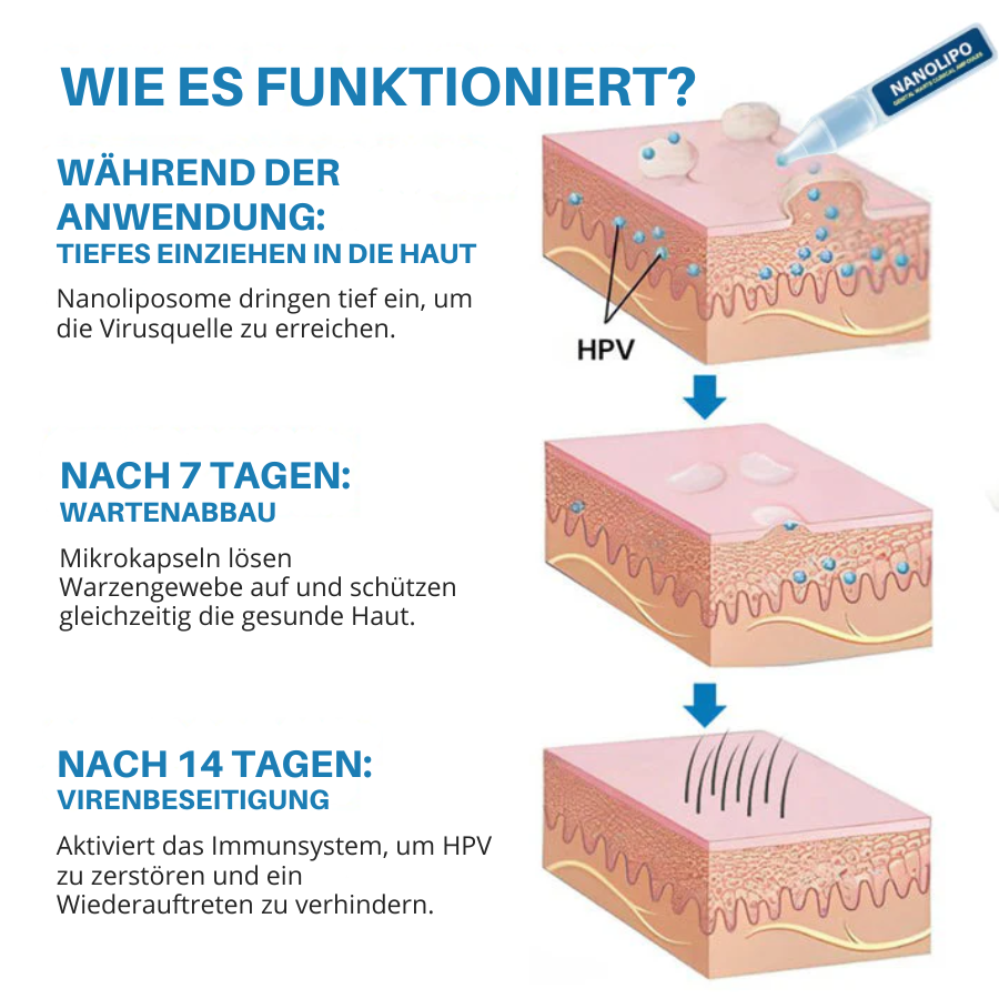 Oveallgo® Nanolipo Genital Warzen Klinische Ampullen