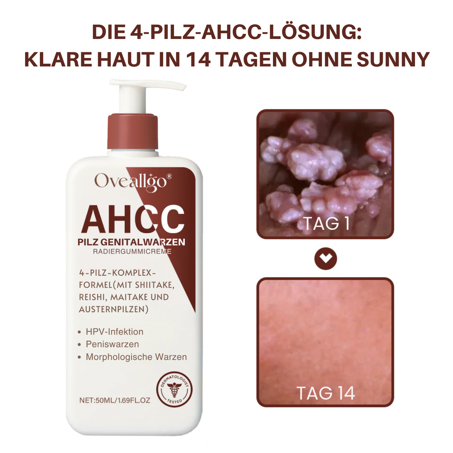 Oveallgo® AHCC-Pilz Genitalwarzen Radiergummicreme