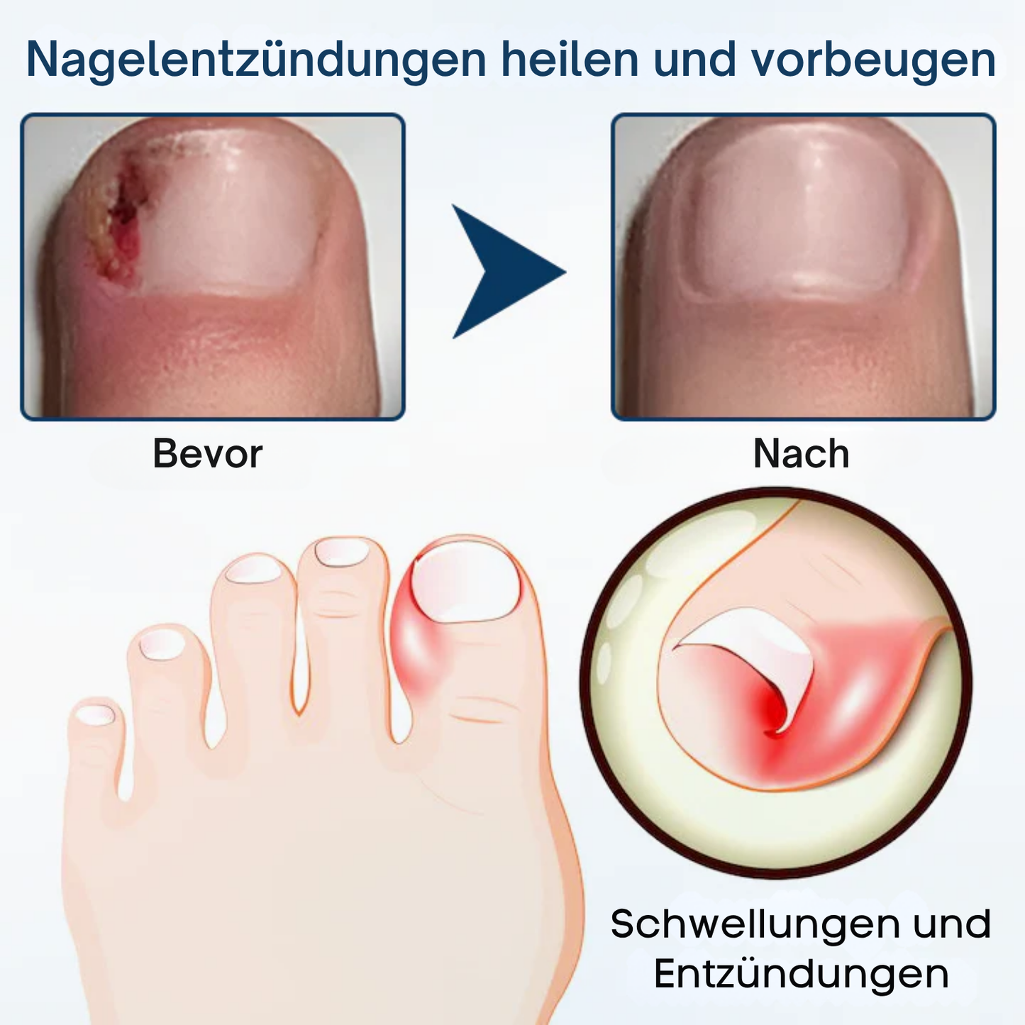 Fivfivgo® OnyxiGuard Pilzreparatur Kräuterspray PRO