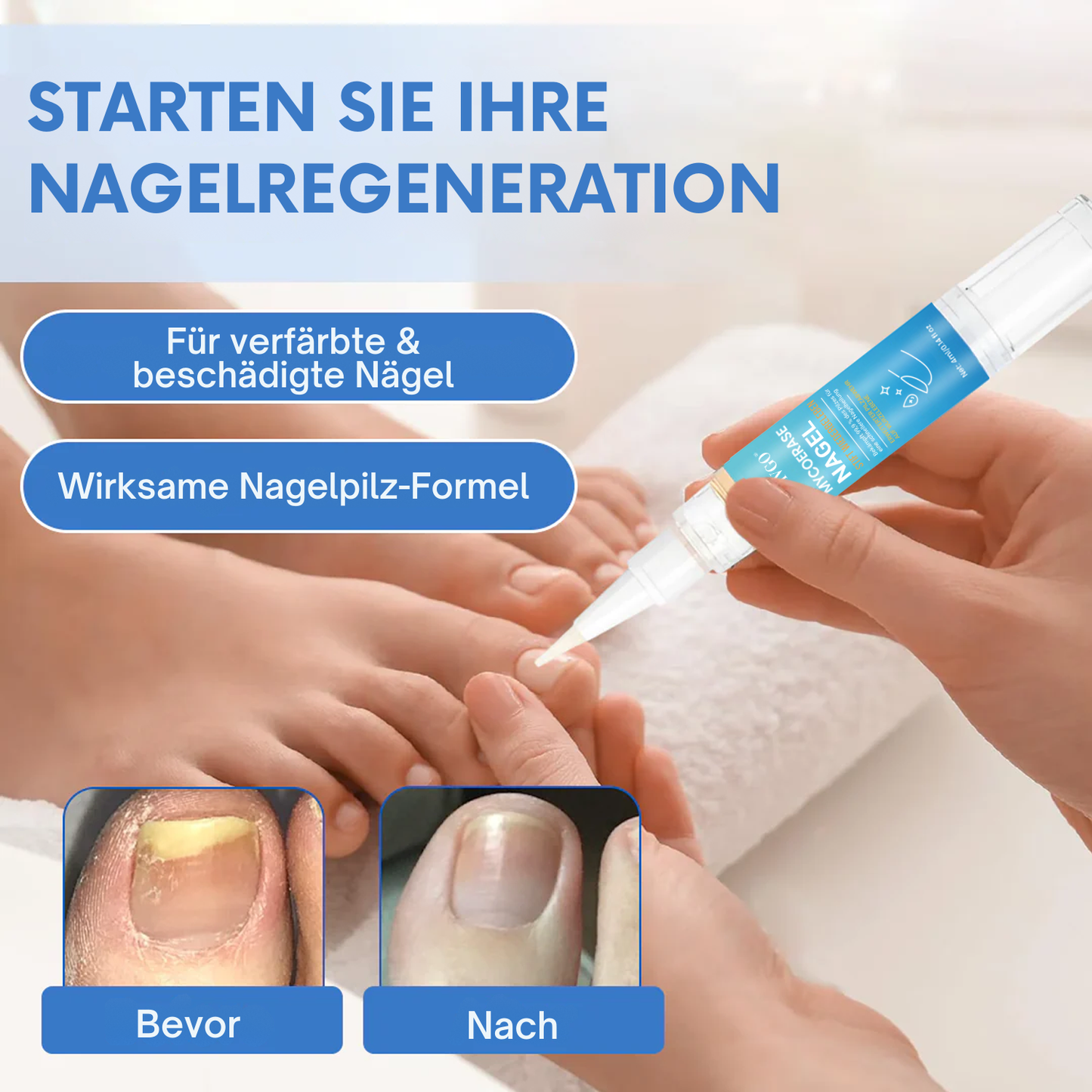 Fivfivgo® MycoErase Nagel Stift Wiederbeleben