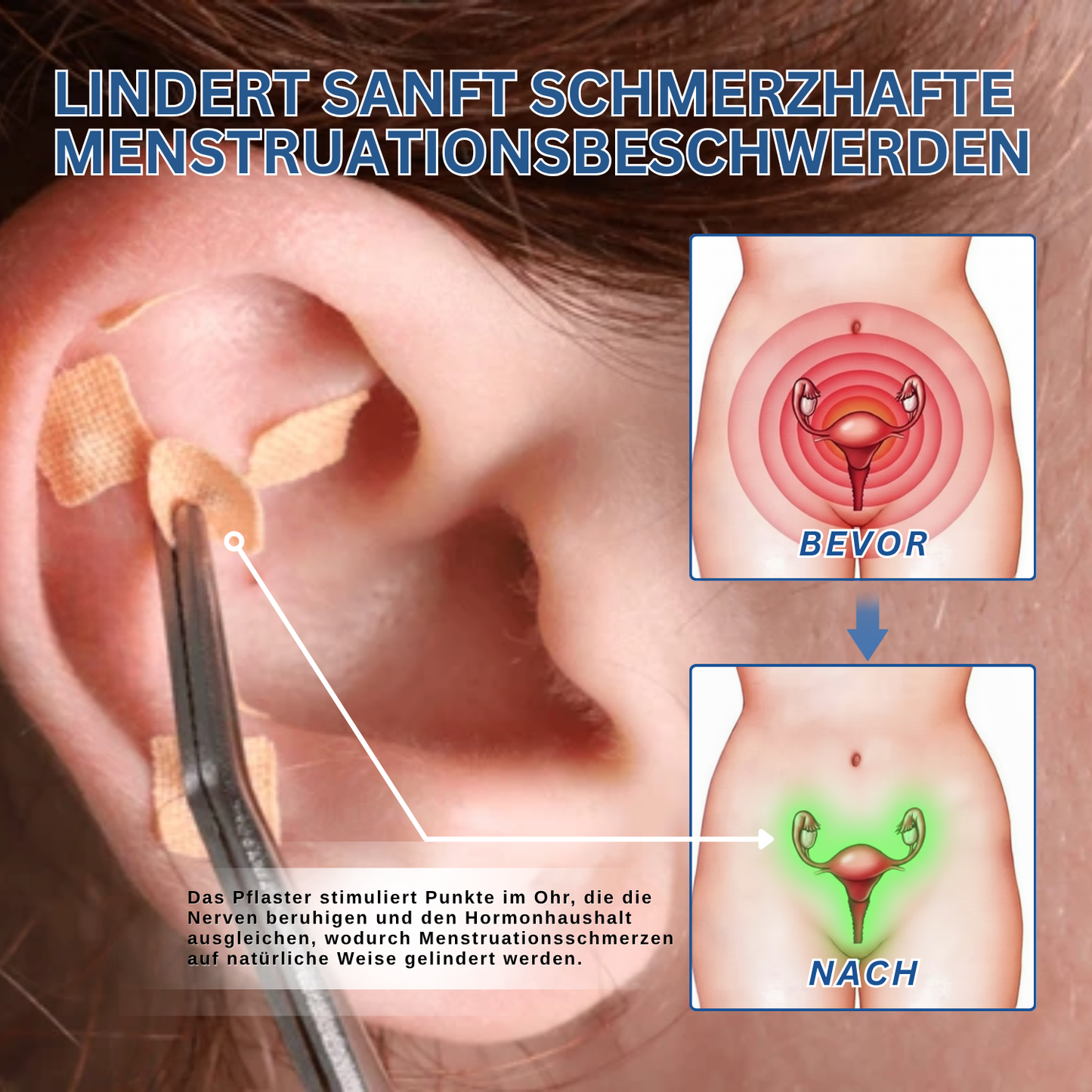 Fivfivgo® Ohrentherapie Magnetisches Akupressurpflaster