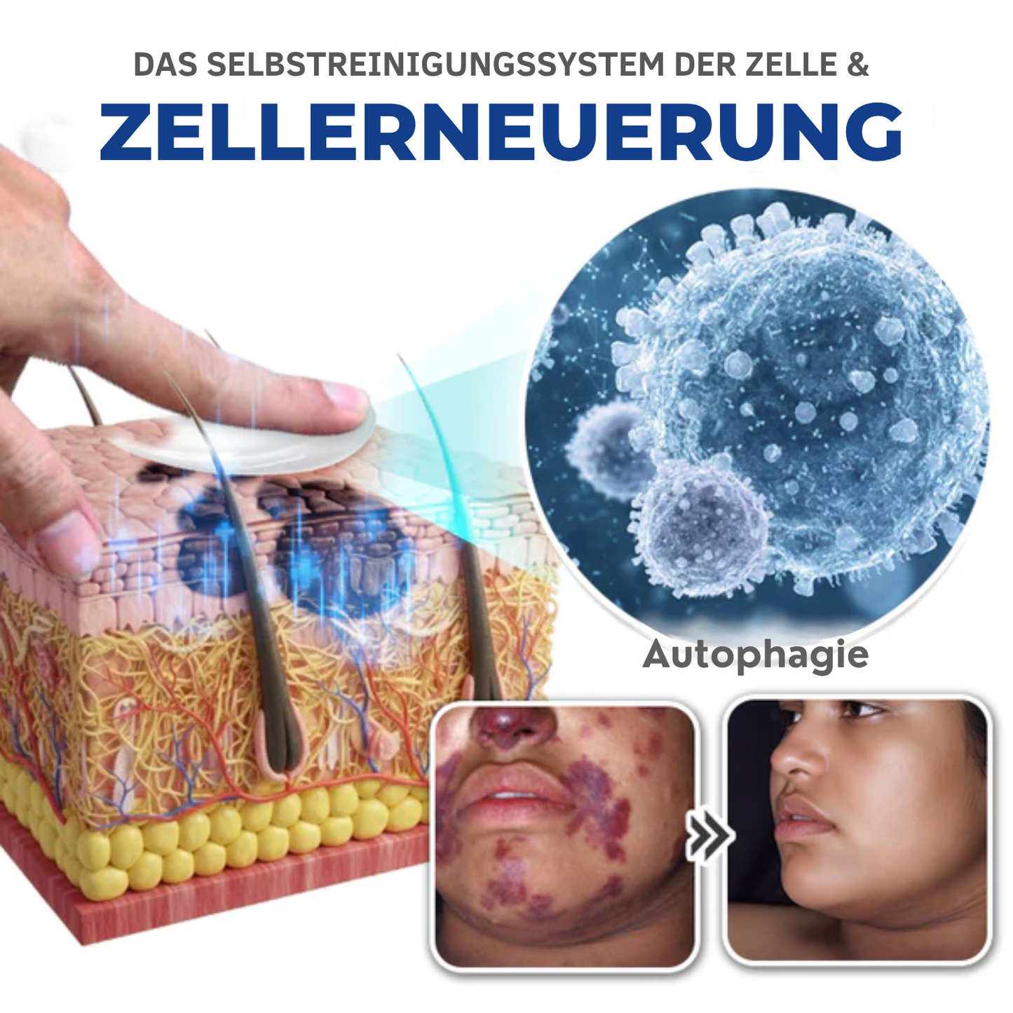 Fivfivgo® Spermidin-Autophagie-Umfassende Creme (Behandelt Hautflecken, Warzen, Ekzeme, Pigmentierung, Keratose)