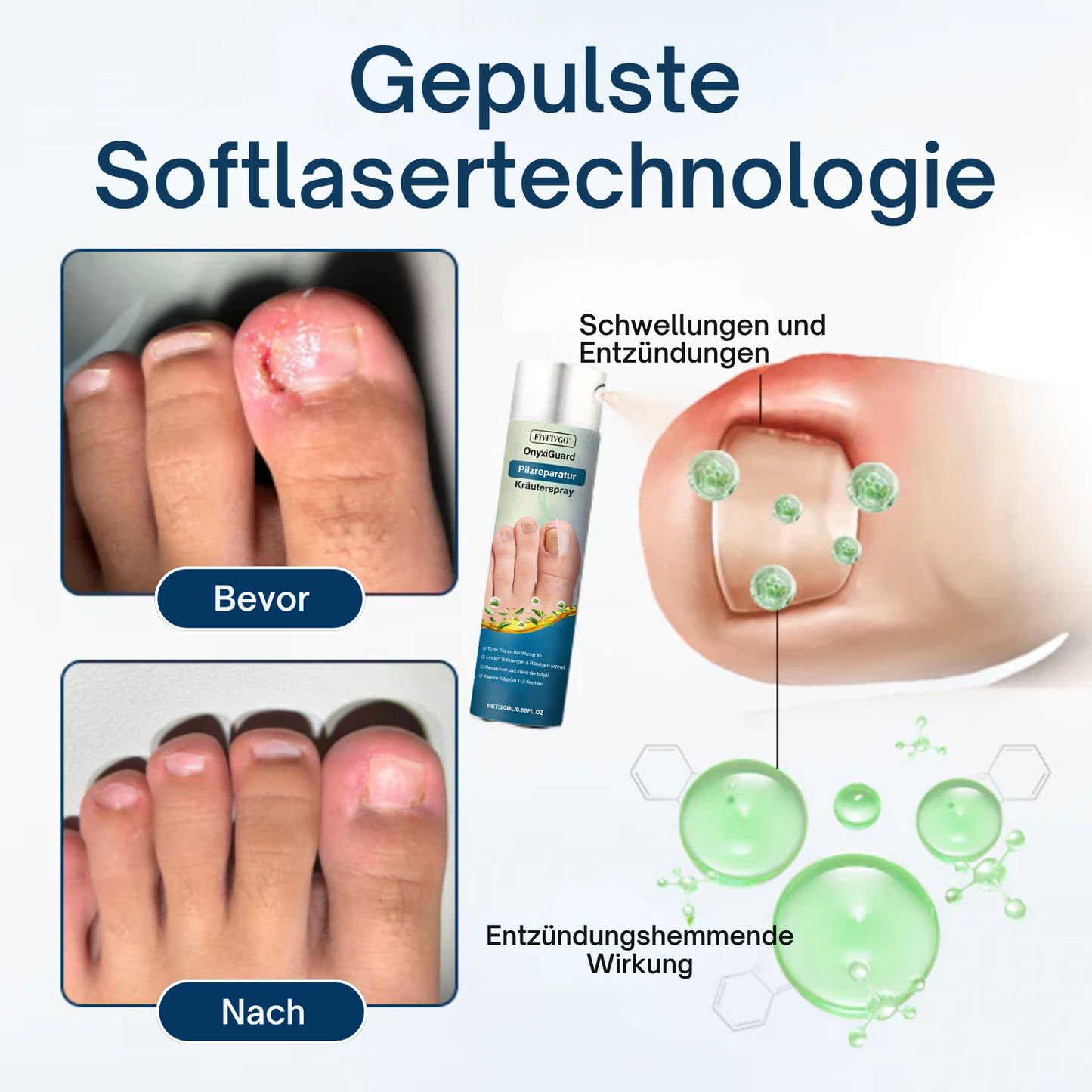 Fivfivgo® OnyxiGuard Pilzreparatur Kräuterspray PRO