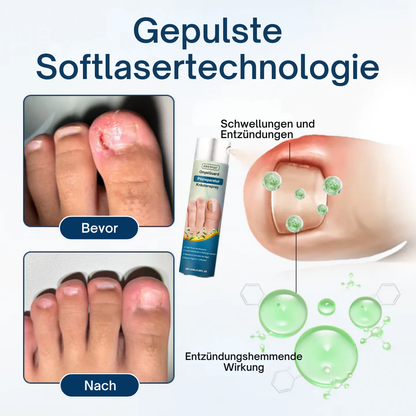 Fivfivgo® OnyxiGuard Pilzreparatur Kräuterspray PRO