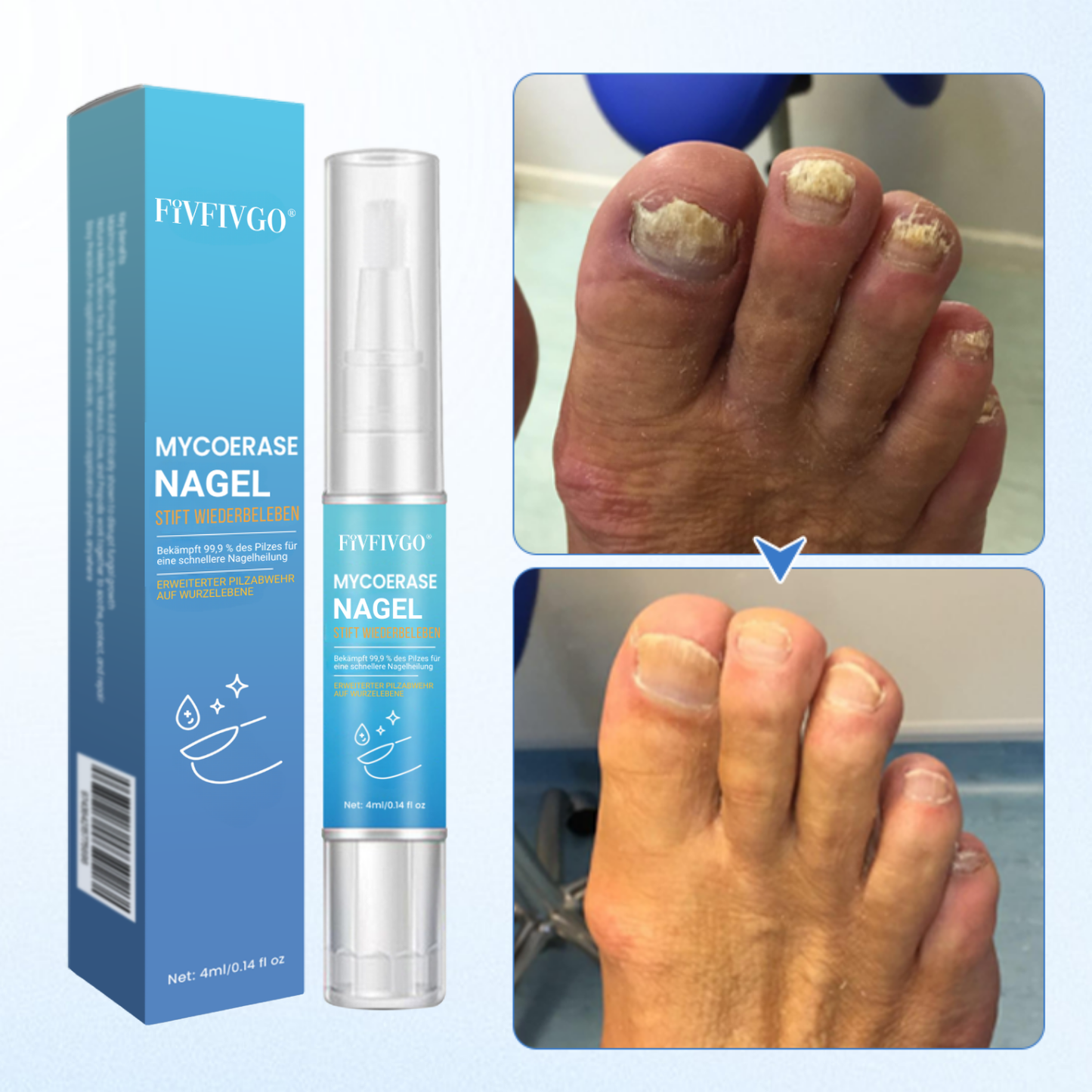 Fivfivgo® MycoErase Nagel Stift Wiederbeleben