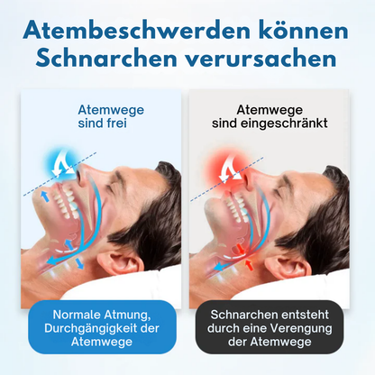 Fivfivgo® SnoreLess Nasenatmer