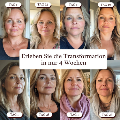 Oveallgo® SculptFix Maske Infundiert mit Retinol und Kollagen um Ihre beste Kieferpartie zu enthüllen