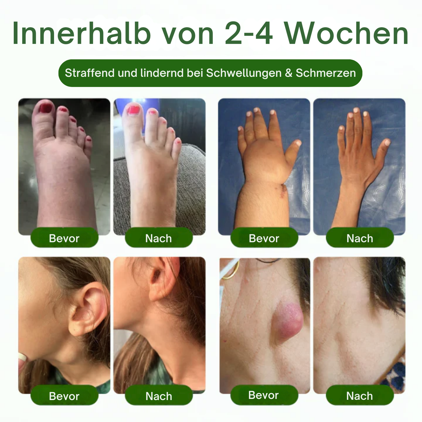 NovaRX® KörperentLastung Zirkulation Creme