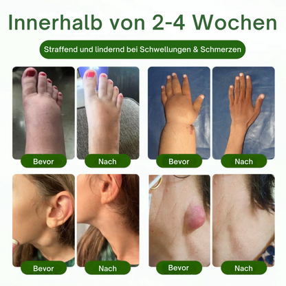 NovaRX® KörperentLastung Zirkulation Creme